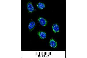 anti-Cytochrome P450, Family 2, Subfamily B, Polypeptide 6 (CYP2B6) (AA 235-263) antibody