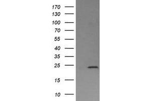 Image no. 3 for anti-Deleted in Primary Ciliary Dyskinesia Homolog (DPCD) antibody (ABIN1497889)