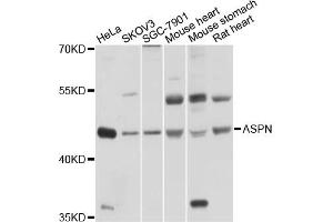 Image no. 1 for anti-Asporin (ASPN) antibody (ABIN4902960)