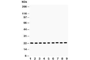 Image no. 2 for anti-Suppressor of Cytokine Signaling 2 (SOCS2) (C-Term) antibody (ABIN3029043)