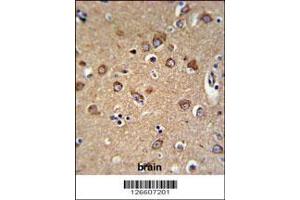 Image no. 1 for anti-Chromosome 12 Open Reading Frame 53 (C12orf53) (AA 75-103), (N-Term) antibody (ABIN651378)
