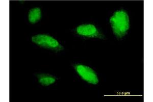 Image no. 5 for anti-Paired-Like Homeobox 2a (PHOX2A) (AA 1-90) antibody (ABIN559952)