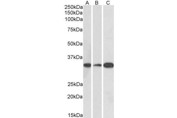 anti-Microtubule-Associated Protein, RP/EB Family, Member 3 (MAPRE3) (AA 151-164) antibody