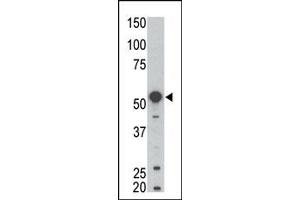 Image no. 1 for anti-B Lymphoid Tyrosine Kinase (BLK) (N-Term) antibody (ABIN359972)