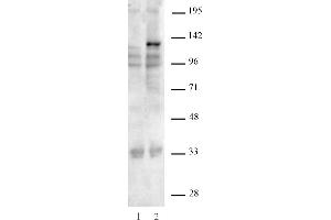 Image no. 1 for anti-CRISPR-Cas9 (AA 1-462) antibody (ABIN6972659)