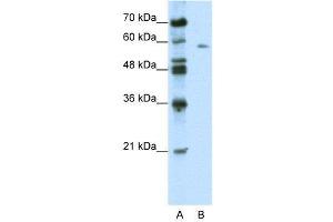 BTBD14A anticorps  (C-Term)