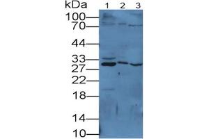 Rabbit Capture antibody from the kit in WB with Positive Control: Sample Lane1: Mouse Cerebrum lysate; Lane2: Mouse Cerebellum lysate; Lane3: Mouse Kidney lysate.