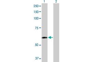 Image no. 1 for anti-TAP Binding Protein-Like (TAPBPL) (AA 1-468) antibody (ABIN527335)