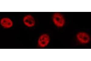 Image no. 3 for anti-Tumor Protein P63 (TP63) antibody (ABIN6265681)