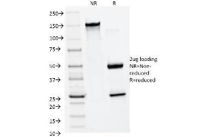 Image no. 3 for anti-Matrix Metalloproteinase 2 (MMP2) (AA 444-575) antibody (ABIN6940067)