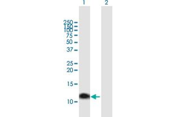 anti-Metallothionein 1A (MT1A) (AA 1-61) antibody