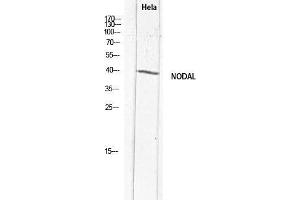 Image no. 2 for anti-Nodal Homolog (NODAL) antibody (ABIN3181748)
