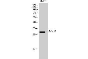 anti-RAB18, Member RAS Oncogene Family (RAB18) (Internal Region) antibody