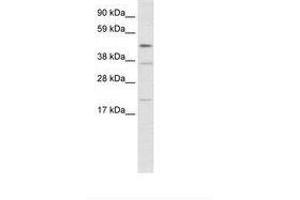 Image no. 1 for anti-TEA Domain Family Member 1 (SV40 Transcriptional Enhancer Factor) (TEAD1) (N-Term) antibody (ABIN202462)