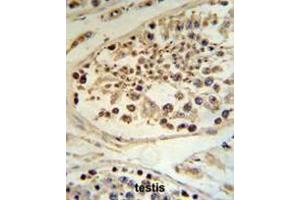Image no. 3 for anti-DEK Oncogene (DEK) (AA 343-372), (C-Term) antibody (ABIN951879)