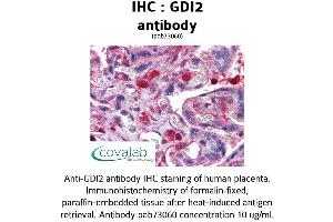 Image no. 1 for anti-GDP Dissociation Inhibitor 2 (GDI2) (AA 1-197) antibody (ABIN1734666)