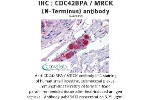 Image no. 2 for anti-CDC42 Binding Protein Kinase alpha (DMPK-Like) (CDC42BPA) (N-Term) antibody (ABIN1732910)