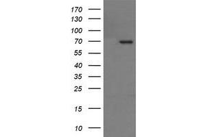 Image no. 5 for anti-Tumor Protein P73 (TP73) (AA 167-409) antibody (ABIN1491005)