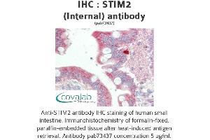 Image no. 3 for anti-Stromal Interaction Molecule 2 (Stim2) (Internal Region) antibody (ABIN1739718)