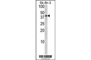 Image no. 1 for anti-Biglycan (BGN) (AA 148-176) antibody (ABIN390701)