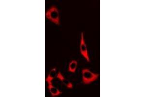 Image no. 1 for anti-S100 Calcium Binding Protein A8 (S100A8) (full length) antibody (ABIN6006068)