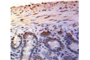 Image no. 2 for anti-Promyelocytic Leukemia (PML) (AA 59-239) antibody (ABIN1175605)