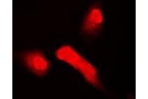 Image no. 1 for anti-T-Box 5 (TBX5) antibody (ABIN2966725)