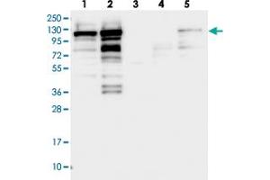 SH3PXD2B antibody