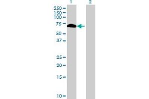Image no. 1 for anti-RNA Binding Motif Protein, Y-Linked, Family 1, Member F (RBMY1F) (AA 1-496) antibody (ABIN531106)
