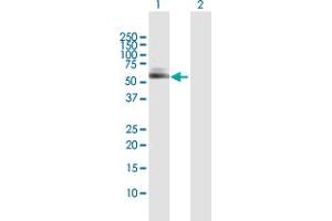 Western Blot analysis of TBCE expression in transfected 293T cell line by TBCE MaxPab polyclonal antibody.