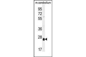 Image no. 1 for anti-Scleraxis (SCXA) (AA 179-209), (C-Term) antibody (ABIN954689)