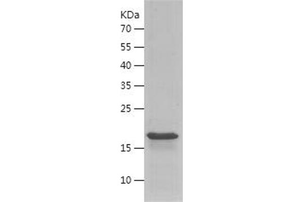 KDM4A Protein (AA 888-1023) (His tag)