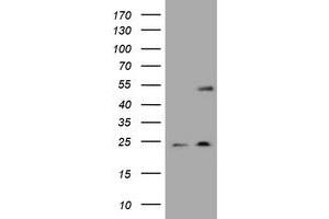 Image no. 4 for anti-Keratin 20 (KRT20) (AA 1-266) antibody (ABIN1490690)
