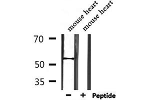 Image no. 2 for anti-tRNA Methyltransferase 11 Homolog (Trmt11) (C-Term) antibody (ABIN6265754)