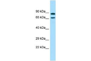Image no. 1 for anti-Premature Ovarian Failure, 1B (POF1B) (C-Term) antibody (ABIN2774456)