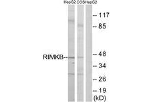 Image no. 1 for anti-Ribosomal Modification Protein RimK-Like Family Member B (RIMKLB) (AA 177-226) antibody (ABIN1535309)
