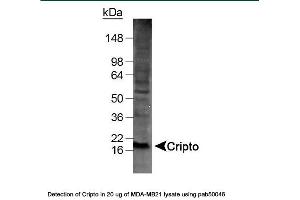 Image no. 1 for anti-Teratocarcinoma-Derived Growth Factor 1 (TDGF1) (AA 100-150) antibody (ABIN363355)
