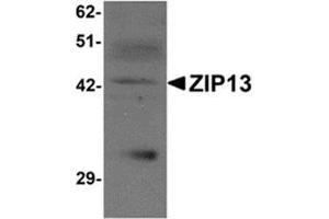 anti-Solute Carrier Family 39 (Zinc Transporter), Member 13 (SLC39A13) (N-Term) antibody