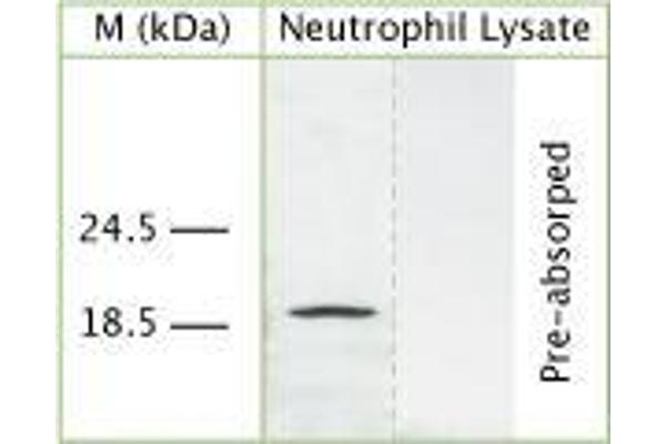 anti-Cathelicidin Antimicrobial Peptide (CAMP) antibody