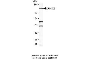 Image no. 1 for anti-Dual Oxidase 2 (DUOX2) (AA 400-500) antibody (ABIN363629)