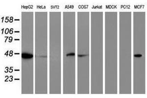 Image no. 2 for anti-Adipocyte Plasma Membrane Associated Protein (APMAP) antibody (ABIN1496665)