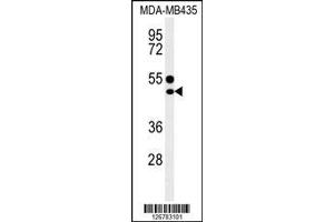 Image no. 1 for anti-CD1e (CD1e) (AA 184-212) antibody (ABIN653900)