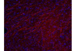 Indirect immunostaining of PFA fixed mouse brain section (dilution 1 : 500; red).