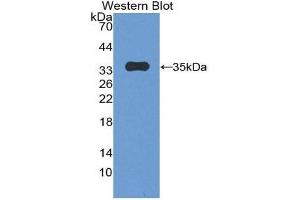 anti-Plakophilin 2 (PKP2) (AA 571-849) antibody