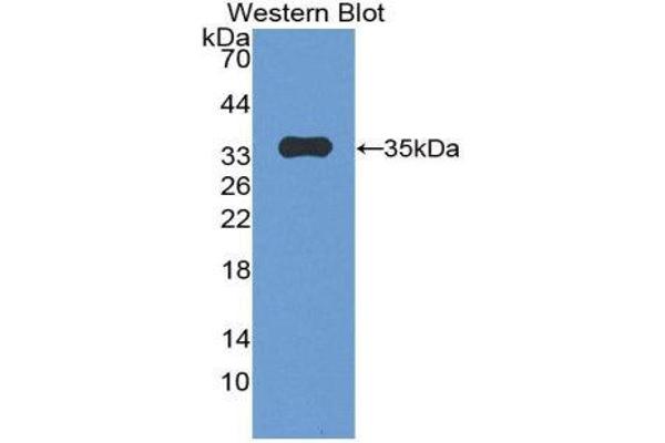 anti-Plakophilin 2 (PKP2) (AA 571-849) antibody