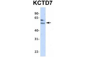 Image no. 4 for anti-Potassium Channel Tetramerisation Domain Containing 7 (KCTD7) (N-Term) antibody (ABIN2776287)