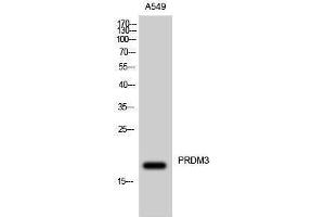 Image no. 1 for anti-MDS1 and EVI1 Complex Locus (MECOM) (N-Term) antibody (ABIN3186554)