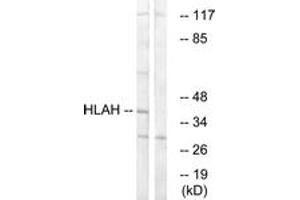 Image no. 1 for anti-Major Histocompatibility Complex, Class I, H (Pseudogene) (HLA-H) (AA 71-120) antibody (ABIN1534979)