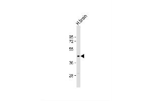 anti-Mitochondrial Carrier 1 (MTCH1) (AA 151-177) antibody
