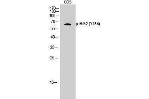 Image no. 1 for anti-Fibroblast Growth Factor Receptor Substrate 2 (FRS2) (pTyr436) antibody (ABIN3182684)